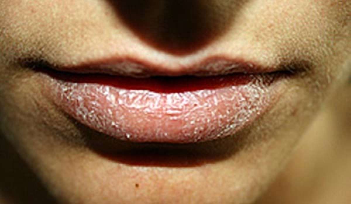 Algunos remedios para prevenir los labios secos en el ciclismo