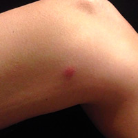 Ametrallar ciclistas en la carretera... lo último que nos faltaba por ver