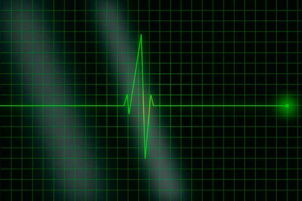 La Fórmula de Karvonen, un método eficaz para calcular nuestras zonas de entrenamiento por frecuencia cardíaca