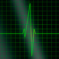 La Fórmula de Karvonen, un método eficaz para calcular nuestras zonas de entrenamiento por frecuencia cardíaca