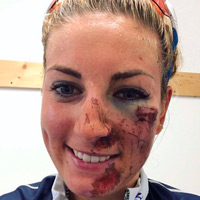 Las imágenes más curiosas del Campeonato del Mundo XCO 2016