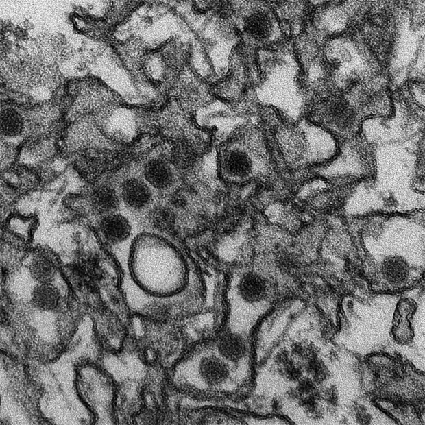 Delincuencia y virus del Zika, o por qué los JJ.OO. de Río van a ser los más peligrosos de la Historia