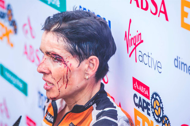 En TodoMountainBike: Sangre, sudor y lágrimas en la primera etapa de la Absa Cape Epic 2017