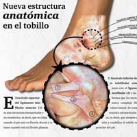 Descubierto un ligamento en el tobillo que podría explicar por qué algunos esguinces presentan dolor crónico