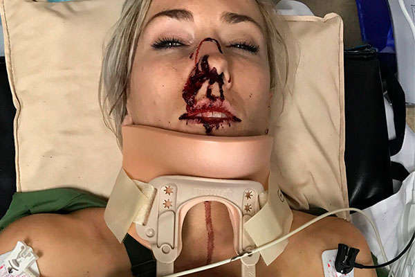Caroline Buchanan, la campeona del mundo de Four Cross, sufre un grave accidente de tráfico
