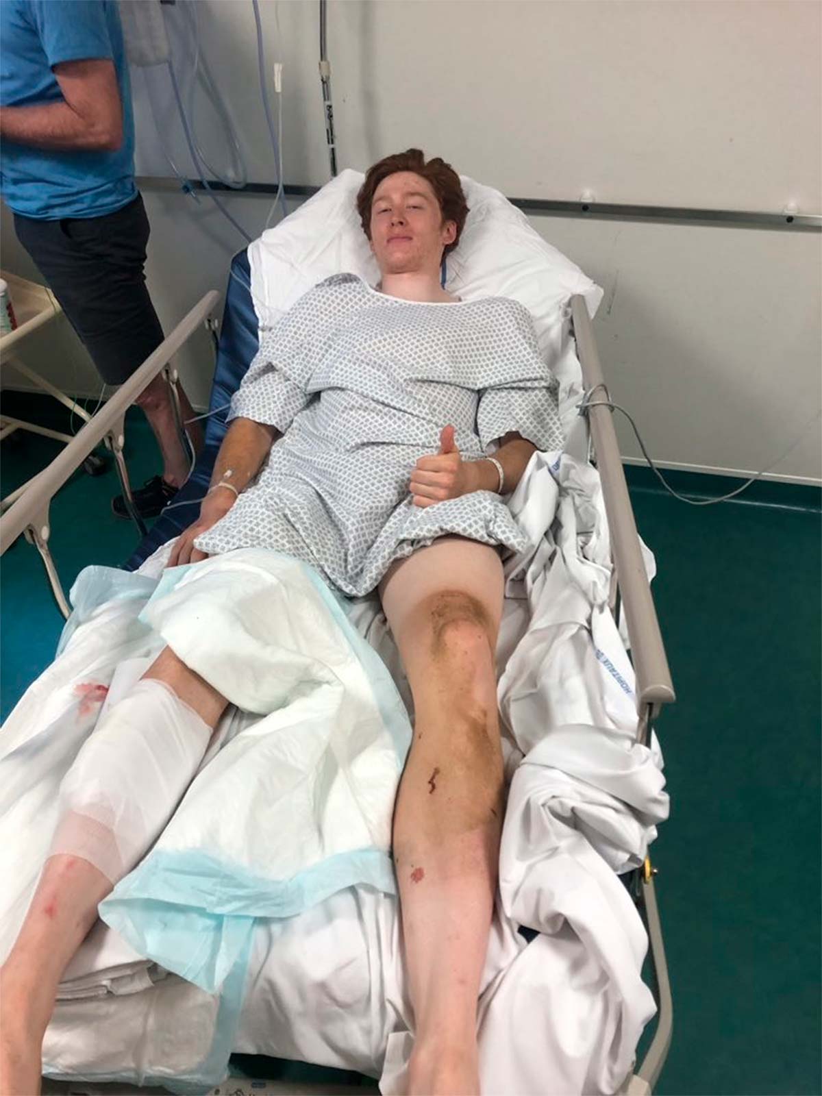 En TodoMountainBike: Los frenos de disco en el pelotón vuelven al punto de mira tras la grave lesión de un ciclista en la París-Roubaix Espoirs