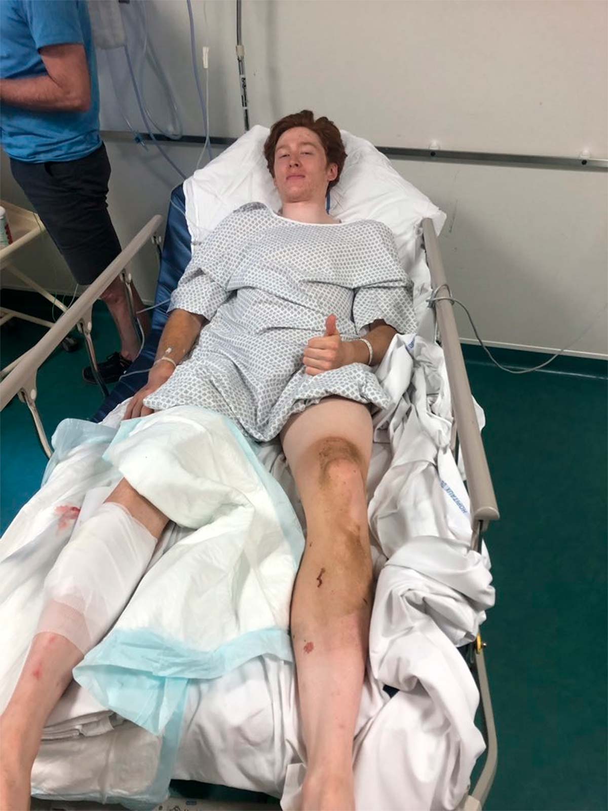 Los frenos de disco en el pelotón vuelven al punto de mira tras la grave lesión de un ciclista en la París-Roubaix Espoirs