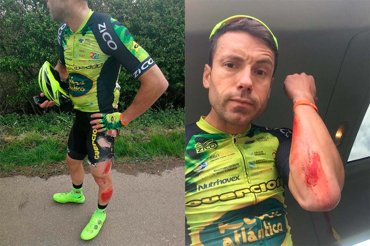 En TodoMountainBike: El ciclista español José Carlos Núñez, atropellado por un coche de apoyo en la Rutland-Melton International Cicle Classic